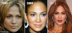 Jennifer Lopez Plastic Surgery